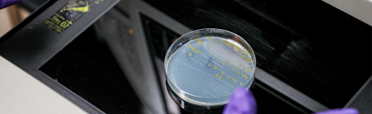 Bacteria growing in a petri dish